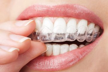Cosmethic dentist